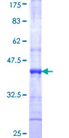 ab159017 on a 12.5% SDS-PAGE stained with Coomassie Blue.