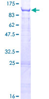 ab163152 on a 12.5% SDS-PAGE stained with Coomassie Blue.