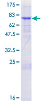 ab163723 on a 12.5% SDS-PAGE stained with Coomassie Blue.