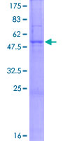 ab163178 on a 12.5% SDS-PAGE stained with Coomassie Blue.