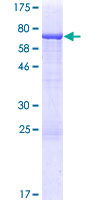 ab162942 on a 12.5% SDS-PAGE stained with Coomassie Blue.