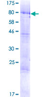 ab162610 on a 12.5% SDS-PAGE stained with Coomassie Blue.