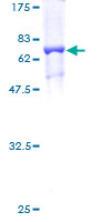ab162412 on a 12.5% SDS-PAGE stained with Coomassie Blue.