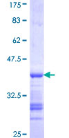 ab160769 on a 12.5% SDS-PAGE stained with Coomassie Blue.