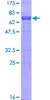ab162233 on a 12.5% SDS-PAGE stained with Coomassie Blue.