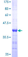ab158268 on a 12.5% SDS-PAGE stained with Coomassie Blue.