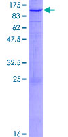 ab161904 on a 12.5% SDS-PAGE stained with Coomassie Blue.