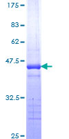 ab161905 on a 12.5% SDS-PAGE stained with Coomassie Blue.