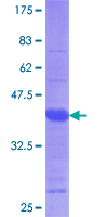 ab153385 on a 12.5% SDS-PAGE stained with Coomassie Blue.