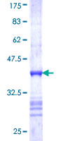 ab153420 on a 12.5% SDS-PAGE stained with Coomassie Blue.
