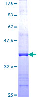ab159983 on a 12.5% SDS-PAGE stained with Coomassie Blue.