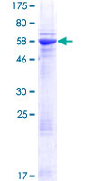 ab162910 on a 12.5% SDS-PAGE stained with Coomassie Blue.