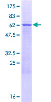 ab165494 on a 12.5% SDS-PAGE stained with Coomassie Blue.