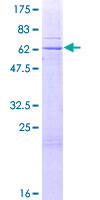 ab162049 on a 12.5% SDS-PAGE stained with Coomassie Blue.