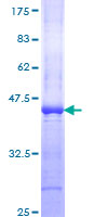 ab159741 on a 12.5% SDS-PAGE stained with Coomassie Blue.