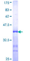 ab160669 on a 12.5% SDS-PAGE stained with Coomassie Blue.