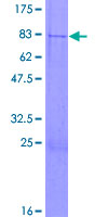 ab163969 on a 12.5% SDS-PAGE stained with Coomassie Blue.