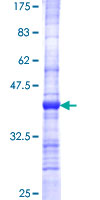ab163970 on a 12.5% SDS-PAGE stained with Coomassie Blue.