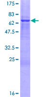 ab160814 on a 12.5% SDS-PAGE stained with Coomassie Blue.