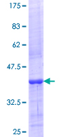 ab160816 on a 12.5% SDS-PAGE stained with Coomassie Blue.