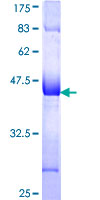 ab164778 on a 12.5% SDS-PAGE stained with Coomassie Blue.