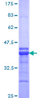 ab160866 on a 12.5% SDS-PAGE stained with Coomassie Blue.