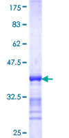 ab163713 on a 12.5% SDS-PAGE stained with Coomassie Blue.