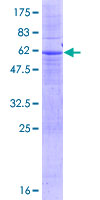 ab161950 on a 12.5% SDS-PAGE stained with Coomassie Blue.
