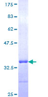 ab160812 on a 12.5% SDS-PAGE stained with Coomassie Blue.