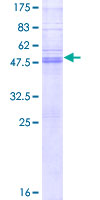 ab160811 on a 12.5% SDS-PAGE stained with Coomassie Blue.