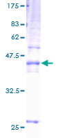 ab159472 on a 12.5% SDS-PAGE stained with Coomassie Blue.
