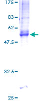 ab160810 on a 12.5% SDS-PAGE stained with Coomassie Blue.