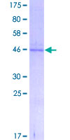 ab159724 on a 12.5% SDS-PAGE stained with Coomassie Blue.