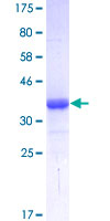ab159725 on a 12.5% SDS-PAGE stained with Coomassie Blue.