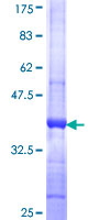 ab159751 on a 12.5% SDS-PAGE stained with Coomassie Blue.