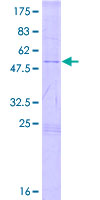 ab161584 on a 12.5% SDS-PAGE stained with Coomassie Blue.