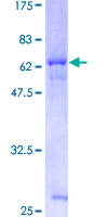 ab161856 on a 12.5% SDS-PAGE stained with Coomassie Blue.