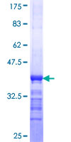 ab161857 on a 12.5% SDS-PAGE stained with Coomassie Blue.