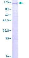 ab162419 on a 12.5% SDS-PAGE stained with Coomassie Blue.