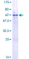 ab160612 on a 12.5% SDS-PAGE stained with Coomassie Blue.