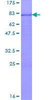 ab165194 on a 12.5% SDS-PAGE stained with Coomassie Blue.