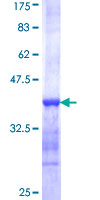 ab165195 on a 12.5% SDS-PAGE stained with Coomassie Blue.