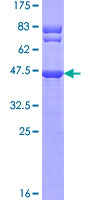 ab166126 on a 12.5% SDS-PAGE stained with Coomassie Blue.