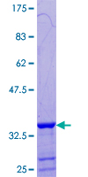 ab166517 on a 12.5% SDS-PAGE stained with Coomassie Blue.