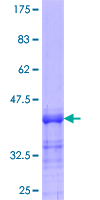 ab165401 on a 12.5% SDS-PAGE stained with Coomassie Blue.