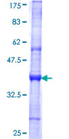 ab165611 on a 12.5% SDS-PAGE stained with Coomassie Blue.