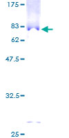 ab161794 on a 12.5% SDS-PAGE stained with Coomassie Blue.