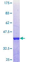 ab161795 on a 12.5% SDS-PAGE stained with Coomassie Blue.