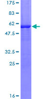 ab159756 on a 12.5% SDS-PAGE stained with Coomassie Blue.
