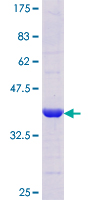 ab159757 on a 12.5% SDS-PAGE stained with Coomassie Blue.